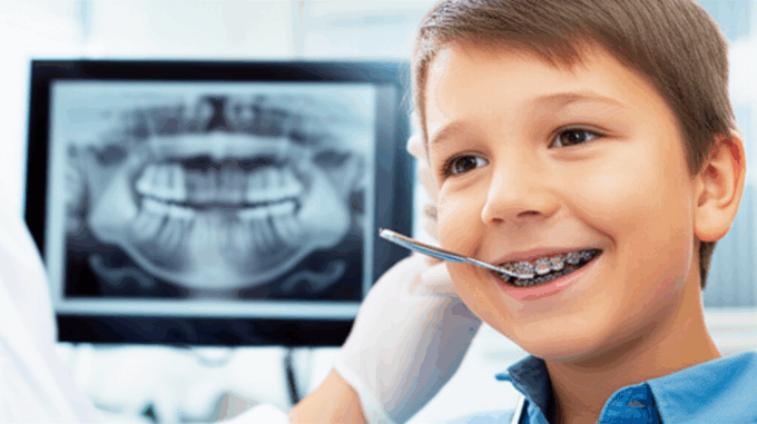 Generate a high-quality, relevant image prompt for an article about: Dental: Best Age for Orthodonti